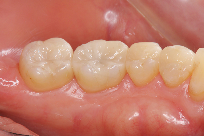 下松市（山口県）の歯医者、たけなわ歯科口腔外科クリニックの審美歯科