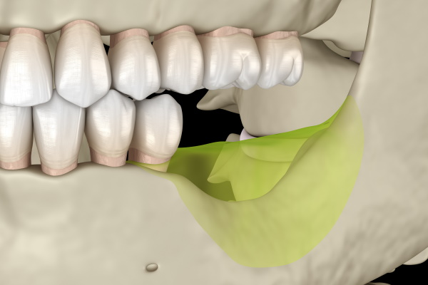 下松市（山口県）の歯医者、たけなわ歯科口腔外科クリニックの歯を失う原因