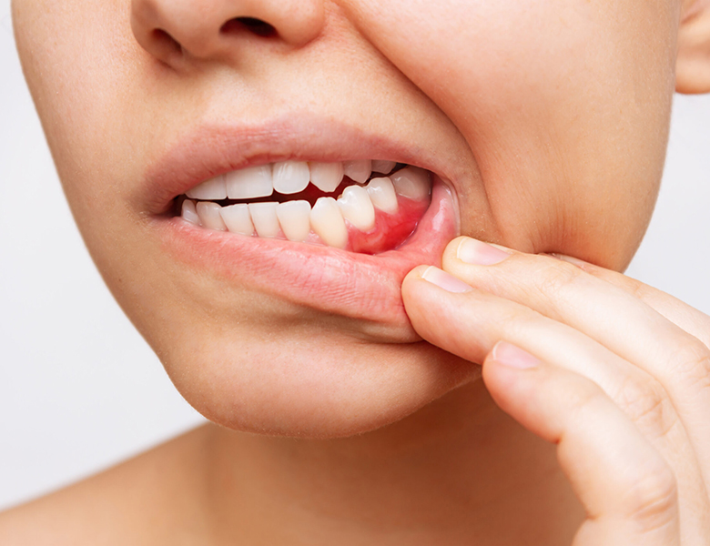 下松市（山口県）の歯医者、たけなわ歯科口腔外科クリニックの歯周病治療