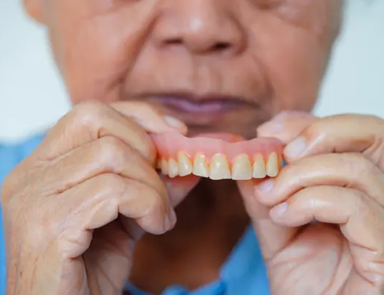 下松市（山口県）の歯医者、たけなわ歯科口腔外科クリニックの入れ歯