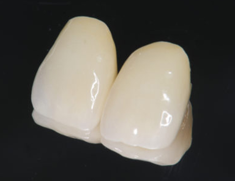 下松市（山口県）の歯医者、たけなわ歯科口腔外科クリニックの審美歯科