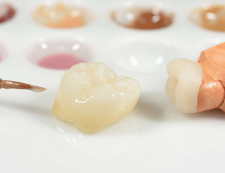 下松市（山口県）の歯医者、たけなわ歯科口腔外科クリニックの審美歯科