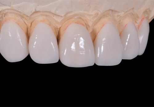 下松市（山口県）の歯医者、たけなわ歯科口腔外科クリニックの審美歯科