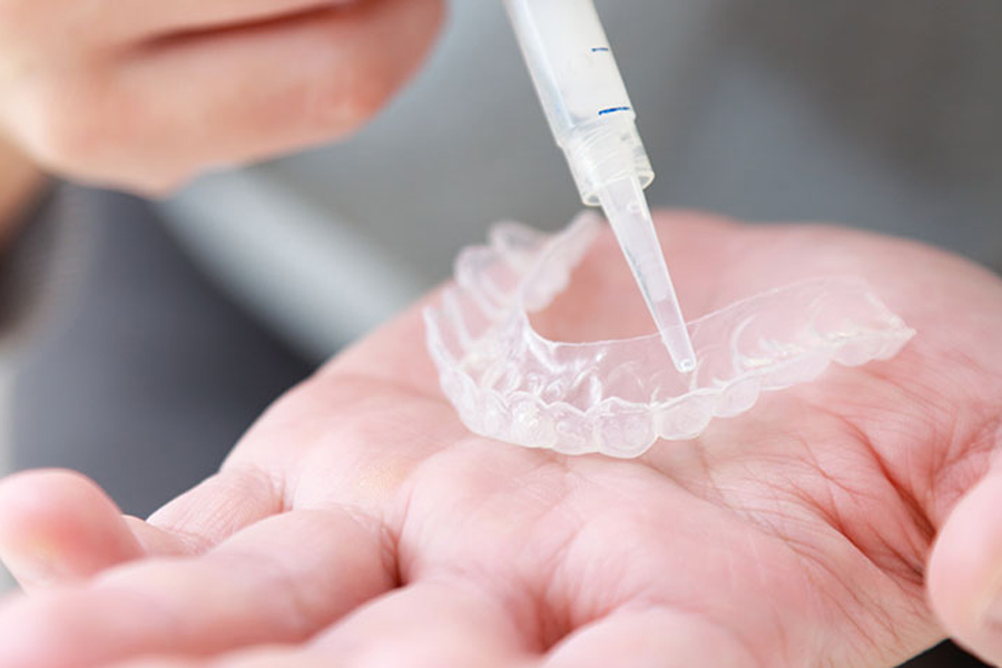 下松市（山口県）の歯医者、たけなわ歯科口腔外科クリニックのホワイトニング