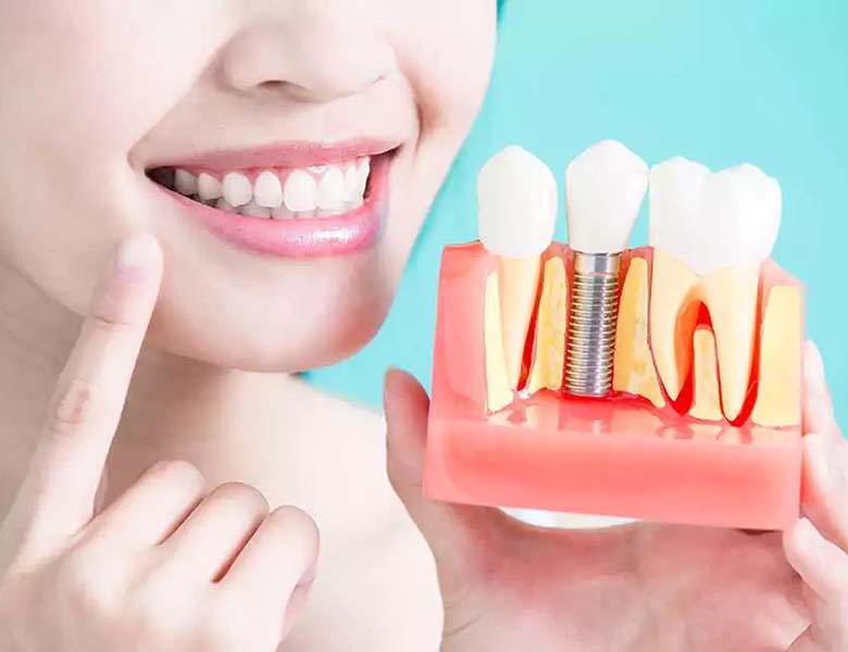 下松市（山口県）の歯医者、たけなわ歯科口腔外科クリニックのインプラント