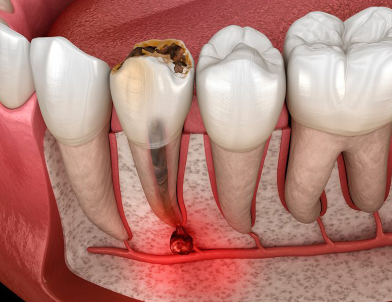 下松市（山口県）の歯医者、たけなわ歯科口腔外科クリニックの口腔外科