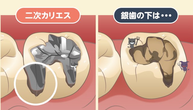 下松市（山口県）の歯医者、たけなわ歯科口腔外科クリニックの審美歯科