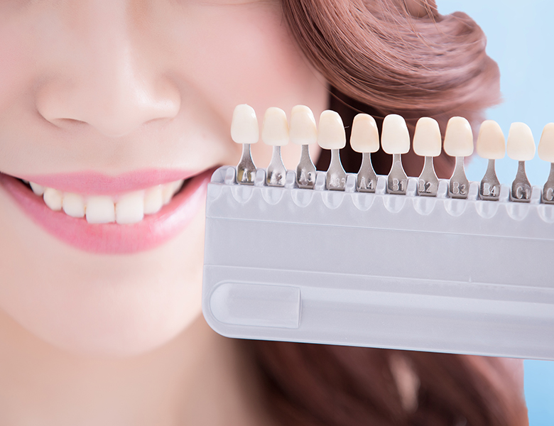 下松市（山口県）の歯医者、たけなわ歯科口腔外科クリニックのホワイトニング