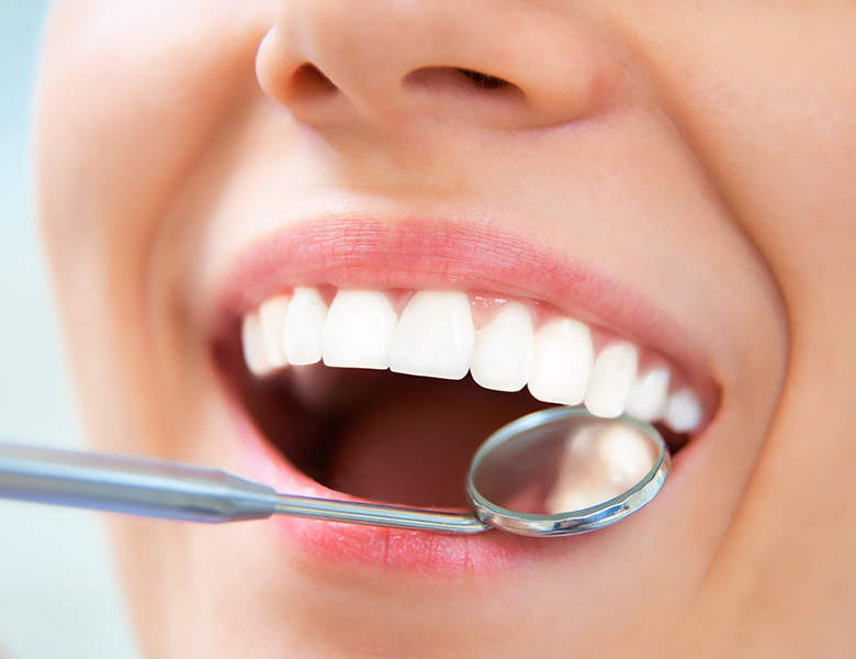 下松市（山口県）の歯医者、たけなわ歯科口腔外科クリニックの予防歯科